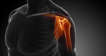 shoulder-injury