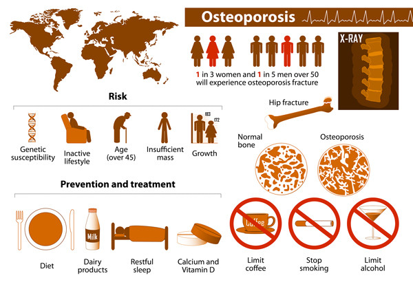 osteoporosis singapore